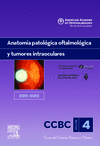 ANATOMÍA PATOLÓGICA OFTALMOLÓGICA Y TUMORES INTRAOCULARES. 2011-2012