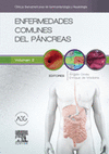 ENFERMEDADES COMUNES DEL PÁNCREAS